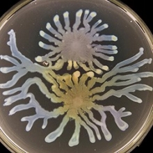 Pseudomonas aeruginosa (Photo by Steve Diggle/Georgia Tech) Pseudomonas aeruginosa (Photo by Steve Diggle/Georgia Tech)