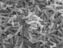 Vibrio cholerae bacteria (Photo Wikimedia Commons) Vibrio cholerae bacteria (Photo Wikimedia Commons)